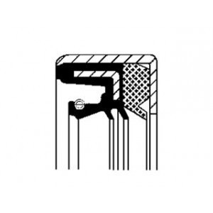 Anello tenuta, differenziale